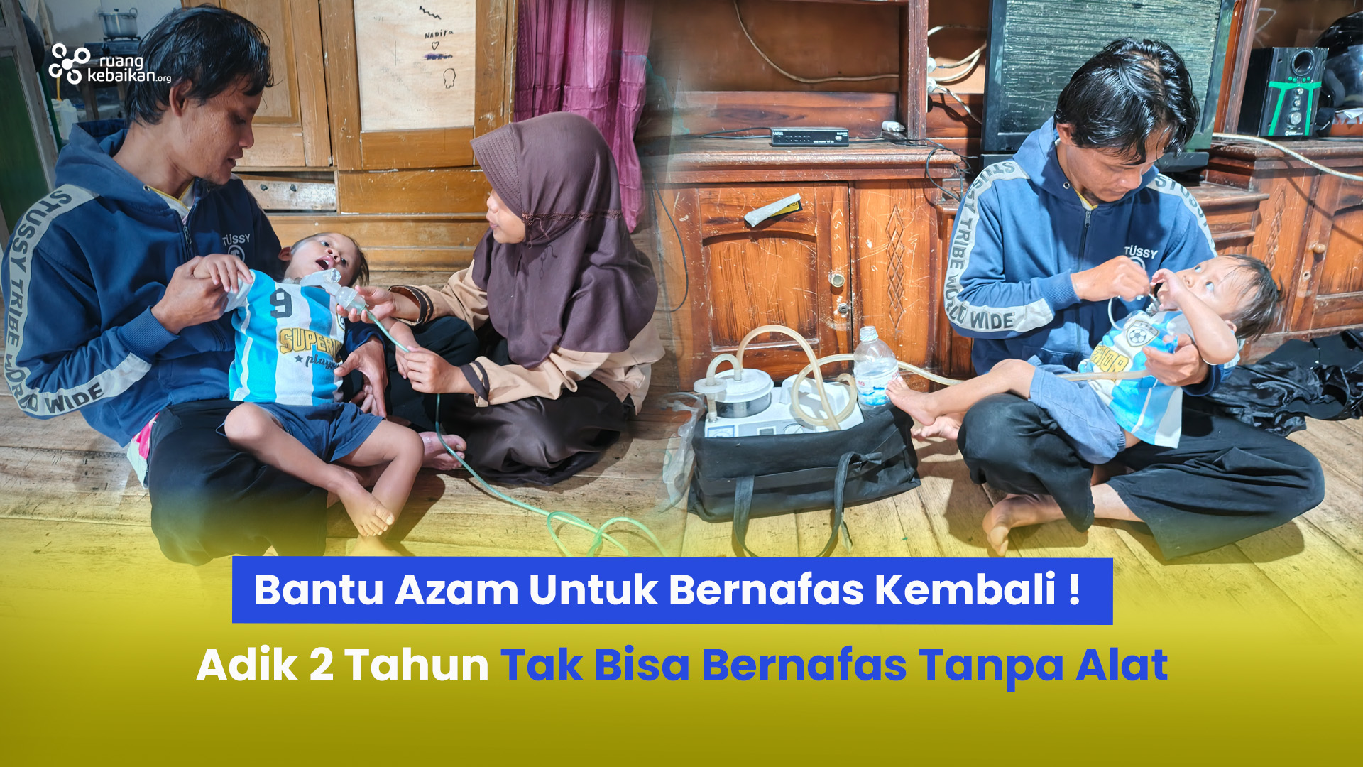 Tak bisa bernafas ! Anak 2 Tahun Bernafas Lewat Alat Bantu