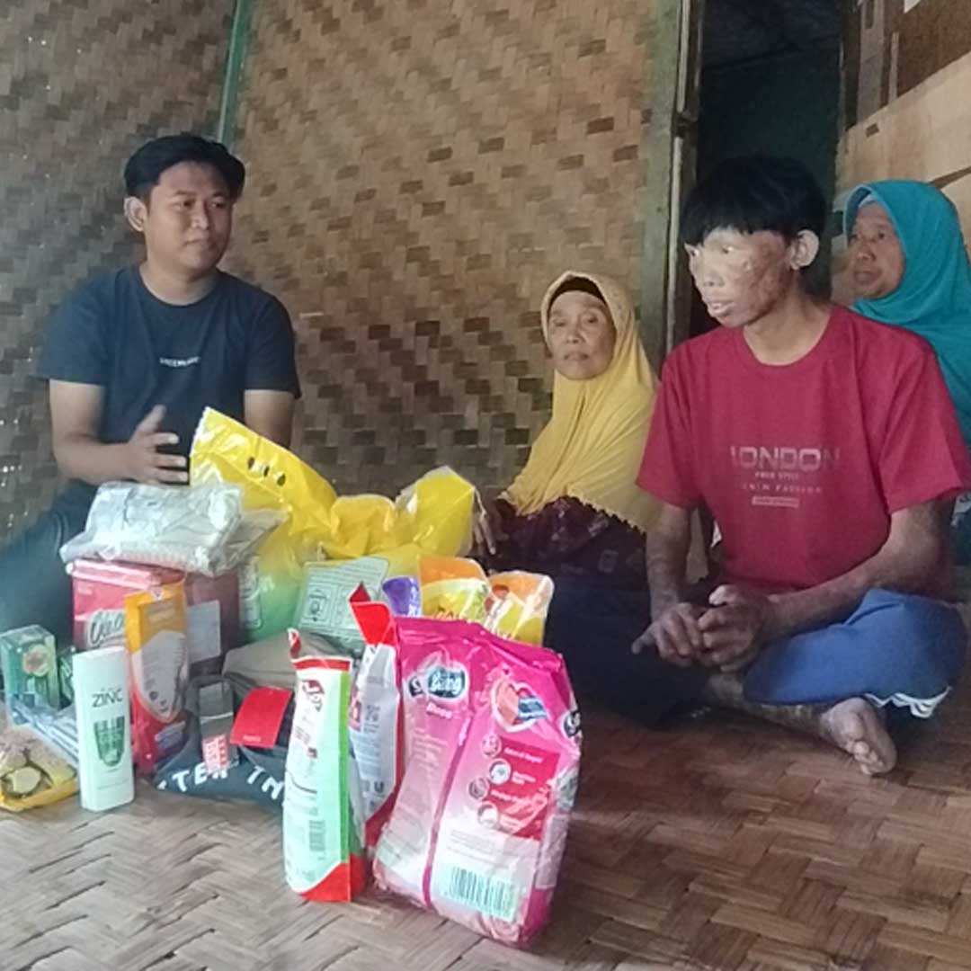 Ribuan Anak Sakit Kronis Terancam Tak Bisa Berobat